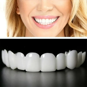 Upper Lower Teeth Veneers - 2 Pairs Simulation Braces Sp On Veneers Smile Fake Teeth Cover Imperfect Teeth Perfect Whitening False Teeth One Size De ZHONGYULI