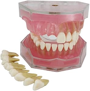 Dental Implant Teeth Model Study Teach Standard Model with Removable Teeth Smile1000