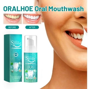 Teissuly Teeth Mouthwash Teeth Mouth Wash - Solve All Oral Problems Teeth Mouthwash Whitening To Tartar Bad Breath Caries 60ml Teissuly