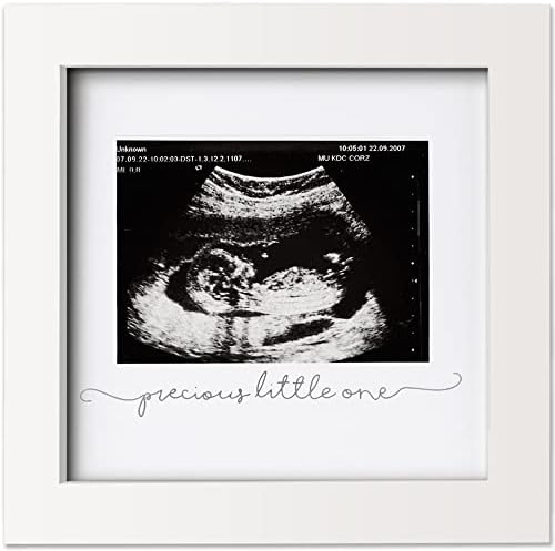 Baby Sonogram Picture Frame - Modern Ultrasound Frame for Mom to Be - Pregnancy Announcement Sonogram Photo Frames - Gender Reveal for Expecting Parents - First Time Dad Gifts (Alpine White) KeaBabies