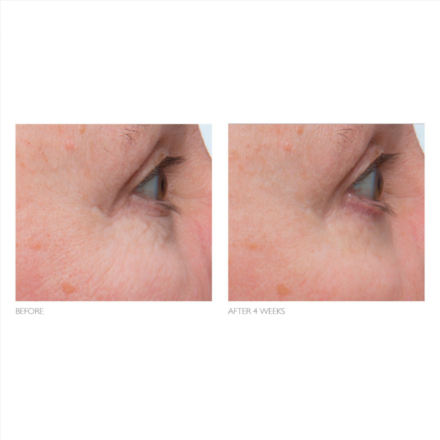 Укрепляющий крем для глаз с ретинолом Kate Somerville