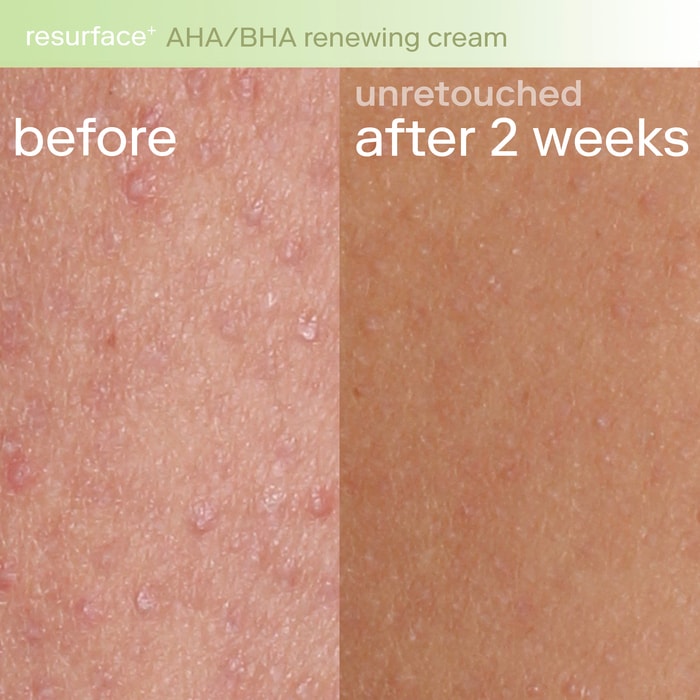 Resurface+ Обновляющий крем для тела с AHA-кислотами Skinfix