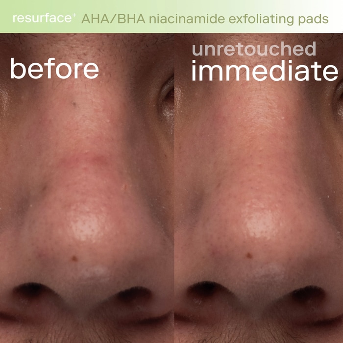 Resurface+ Отшелушивающие подушечки с ниацинамидом AHA/BHA для лица и тела Skinfix