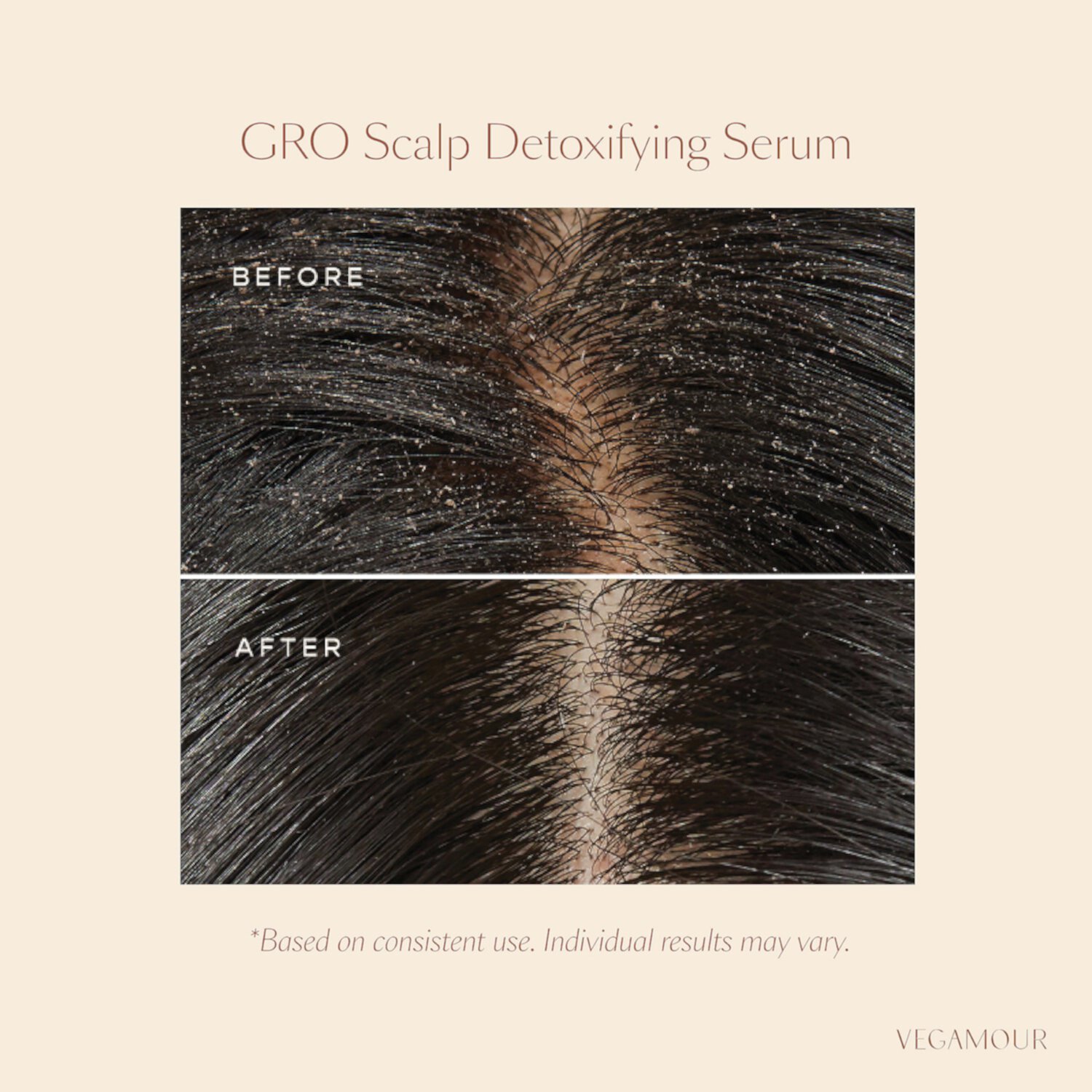 GRO Scalp Detox Очищающее средство для сухой, шелушащейся и жирной кожи головы Vegamour
