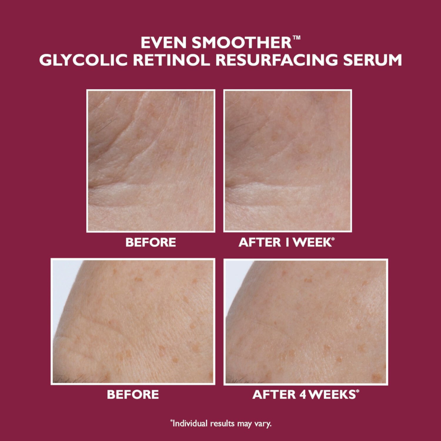 Even Smoother™ Обновляющая сыворотка с гликолевым ретинолом Peter Thomas Roth