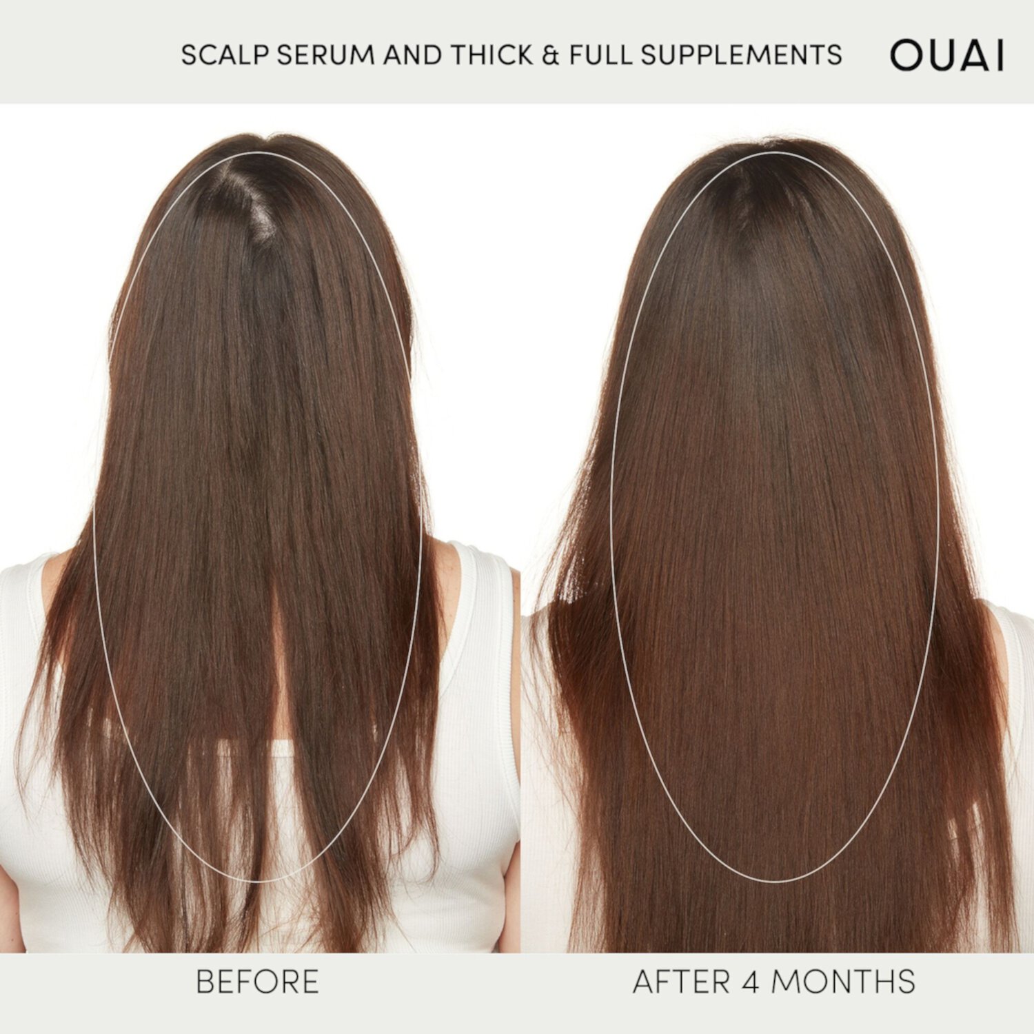 Hydrating Scalp Serum for Healthy, Fuller Looking Hair OUAI