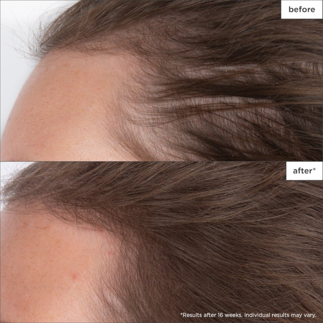 Пептидная сыворотка для волос Destined for Density™ для более густых и густых волос Briogeo
