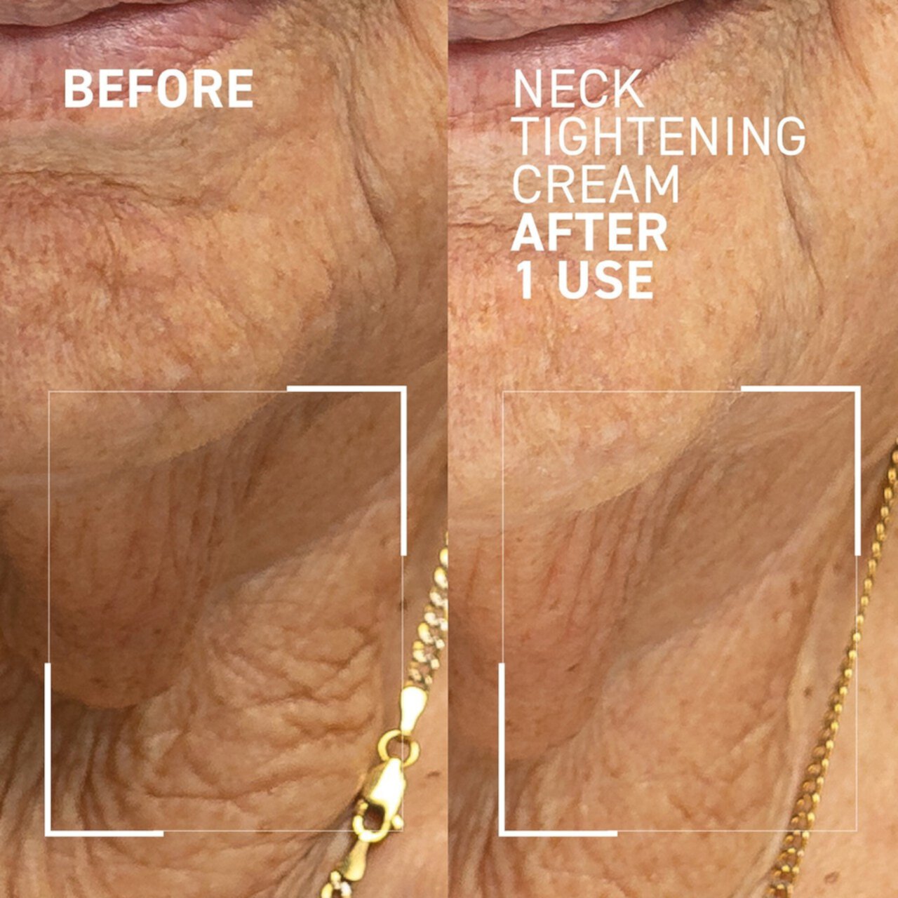 Neck Tightening Cream Dr. Brandt Skincare