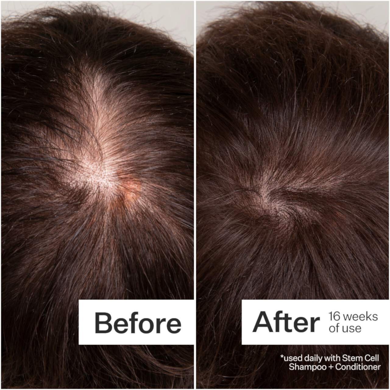 3% Stem Cell Peptide H3-Grow+ Complex™ Scalp Treatment For Thicker Fuller-Looking Hair Act+Acre