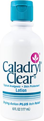 Lotion for Dry Skin by Caladryl, Topical Analgesic for Itch Relief, 6 Fl Oz Caladryl