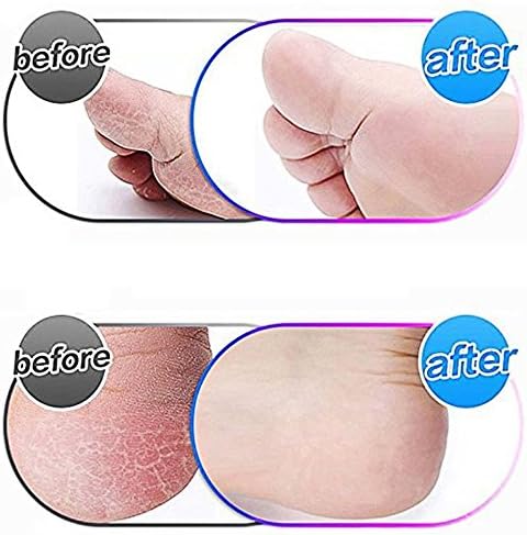 4 Pack Blue Replacement Roller Compatible with Scholl Express Pedi Foot Smoother-Extra Coarse MOVELOVE