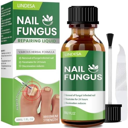 Toenail Fungus Treatment Extra Strength,Toenail Fungus Treatment,Nail Fungus Treatment Extra Strength for Athletes Foot, Thick, Broken, Discolored & Damaged Nail-30Ml Calpol