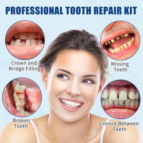 Tooth Repair Kit, Temporary Teeth Replacement Kit, Dental Care Kit Repair for Broken Chipped Teeth, Missing Teeth, Crown Fillings & Bridges, Make You Smile Confidently Again Generic