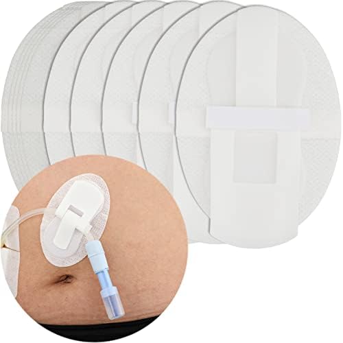 Low-Profile Catheter Stabilization Device for Kids Baby's Gtube Feeding Tube G J Tube Peg Pd Catheter Holder Peritoneal Dialysis Accessories Adhesive Patch Dressing (Pack of 10) DiaBelt