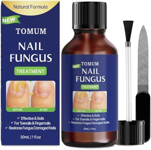 Toe Finger Nail Fungus Treatment: Hongos fungal Remover Extra Strength Liquid - Fingernail Fungi Aid Care Kit - Crystal Flush Repair Tools - (30ml/1fl oz) Evervines