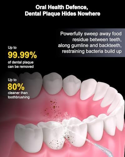 MySmile Powerful Cordless 350ML Water Dental Flosser Portable OLED Display Oral Irrigator with 5 Pressure Modes 8 Replaceable Jet Tips and Storage Bag for Home Travel Use (White) MySmile