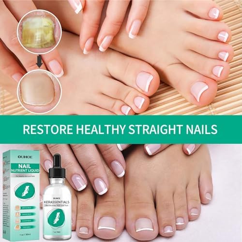 Kerassentials Nails Nutrient Oil,Kerassentials Toenail Oil,Nail Repair Solution,Nail Renewal Liquid (Жидкость) For Damaged & Discoloration Nail (colorless 3PC) JeurLrok