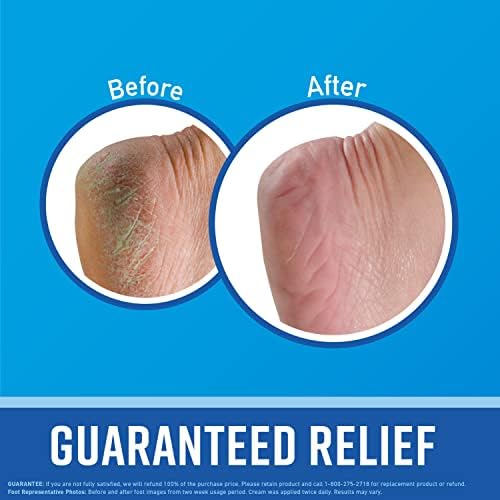 O'Keeffe's for Healthy Feet Foot Cream; Guaranteed Relief for Extremely Dry; Cracked Feet; Clinically Proven to Instantly Boost Moisture Levels; 3.0 Ounce Tube; (Pack of 1) O'Keeffe's