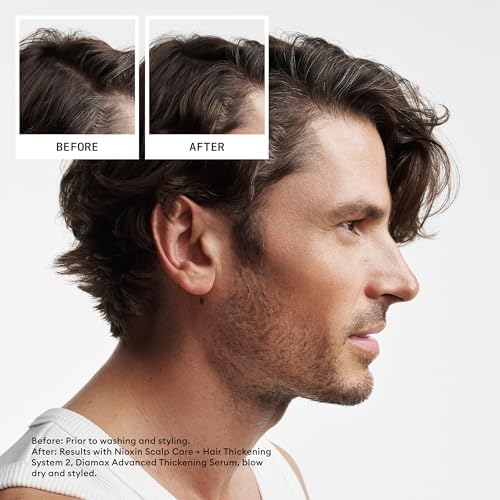 Nioxin Scalp & Hair Leave-In Treatment, Restore Hair Fullness, Prevent & Relieve Dry Scalp Symptoms Nioxin