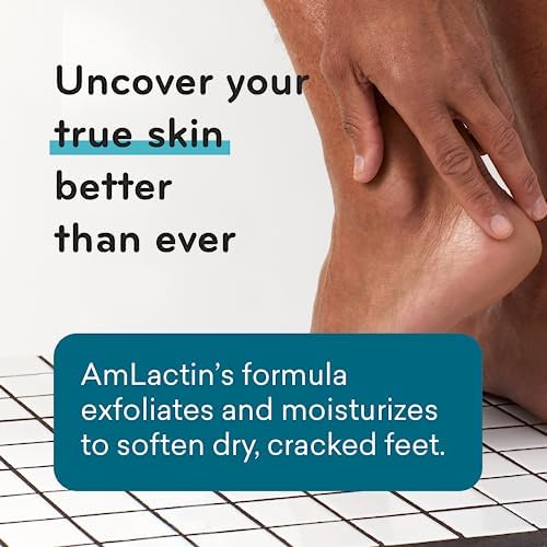 AmLactin Foot Repair Cream - 3 oz Foot Cream for Dry Cracked Heels with 15% Lactic Acid - Exfoliator and Moisturizer for Dry Skin & Foot Care (Packaging May Vary) Amlactin