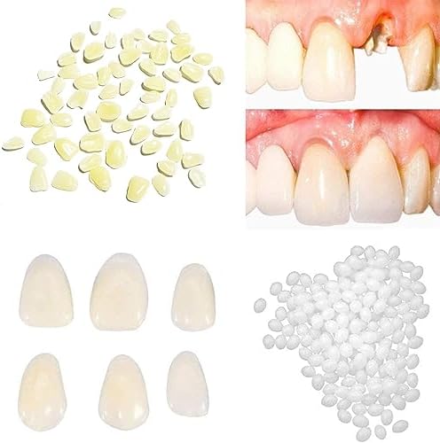 Tooth Repair Kit-Thermal Fitting Beads Granules and Fake Teeth for Temporary Fixing Missing and Broken Tooth，Replace a Missing Tooth in Minutes for Women and Man (Natural Yellow) ZENPEACE