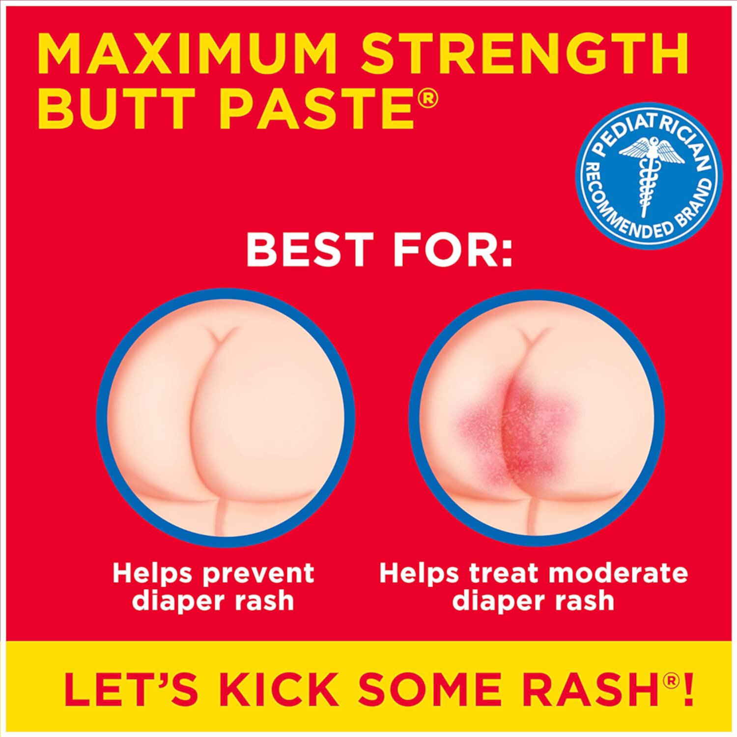 Boudreaux's Butt Paste Maximum Strength Diaper Rash Cream, Ointment for Baby, 4 oz Tube (Pack of 4) Visit the Boudreaux's Butt Paste Store