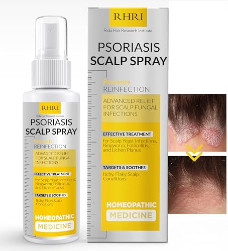 Psoriasis Scalp Spray | Dandruff Treatment for Scalp Yeast Infections, Psoriasis & Folliculitis | Antifungal & Ringworm Itchy Scalp Treatment Formula Spray for Dryness and Fungal Infections Rida Hair Research Institute