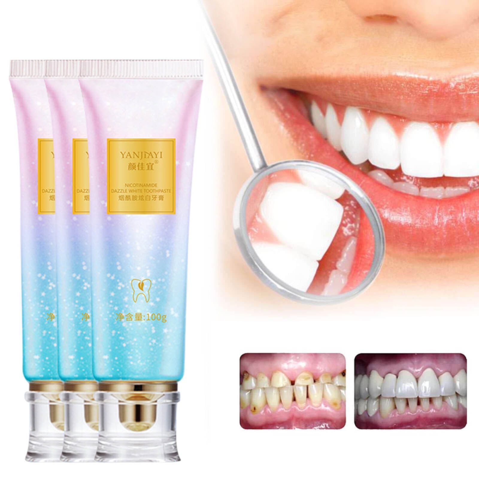 Niacinamide Whitening Toothpaste, Body Accel Niacinamide Whitening Toothpaste, Niacinamide Toothpaste, Teeth Whitening Toothpaste, Stain Removal and Whitening Langlia