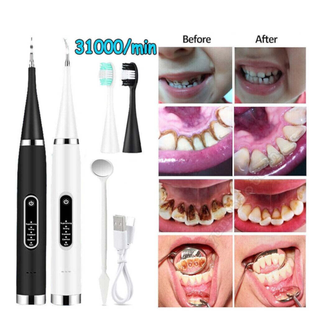 Electric Sonic Dental Scaler Tartar Plaque Calculus Remover Teeth Stains Cleaner Unbrand