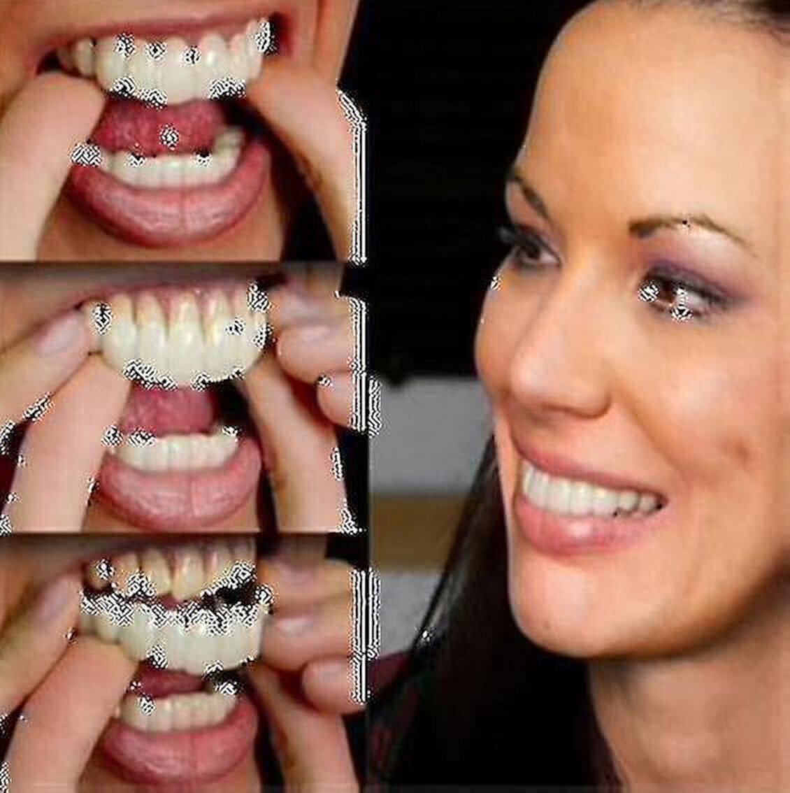 Pair Of Upper And Lower High Quality Dentures Instant Smile Comfortable Fit Elastic Cosmetic Dental Dentures ZHONGYULI