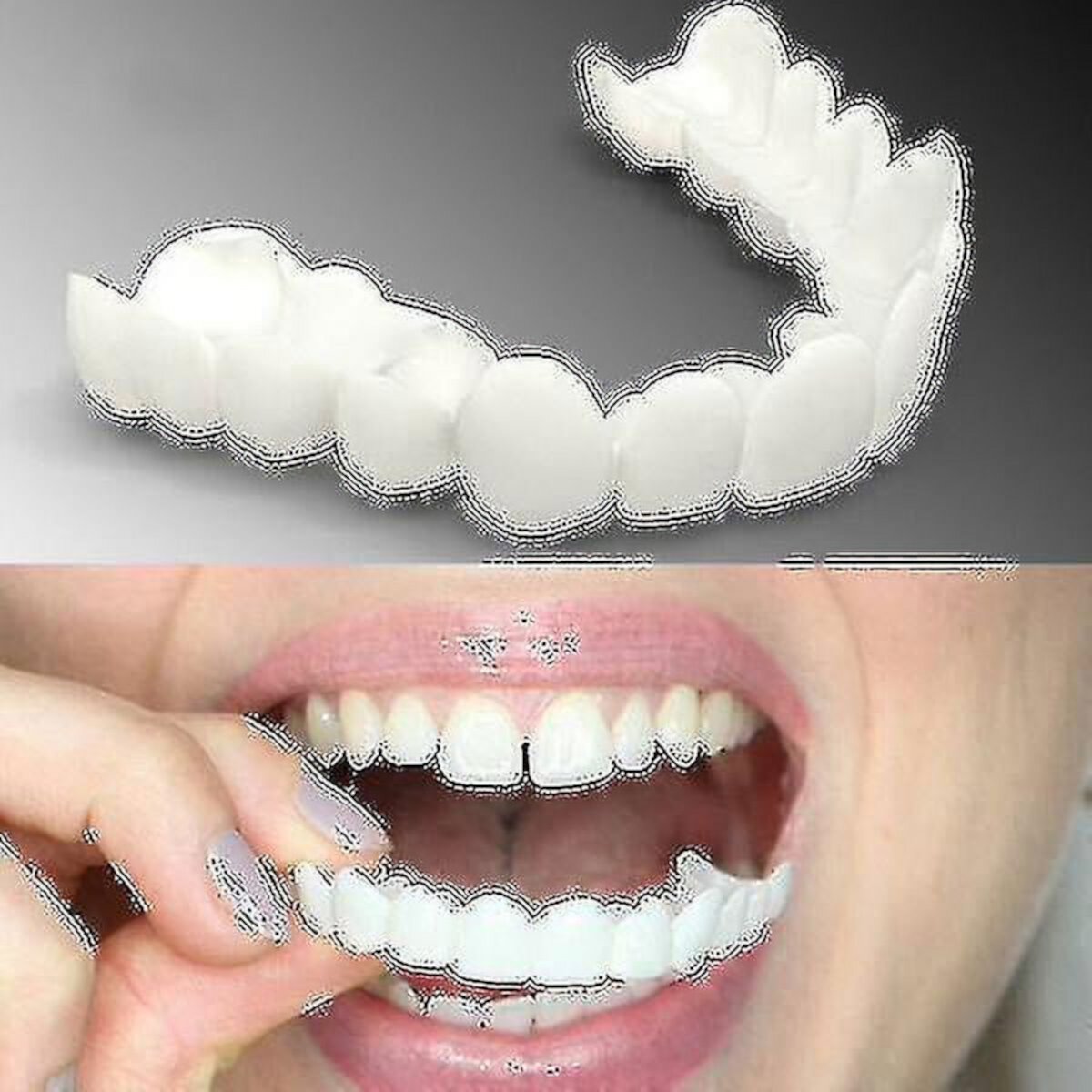 Upper/lower Comfort Fit Flex Denture ZHONGYULI