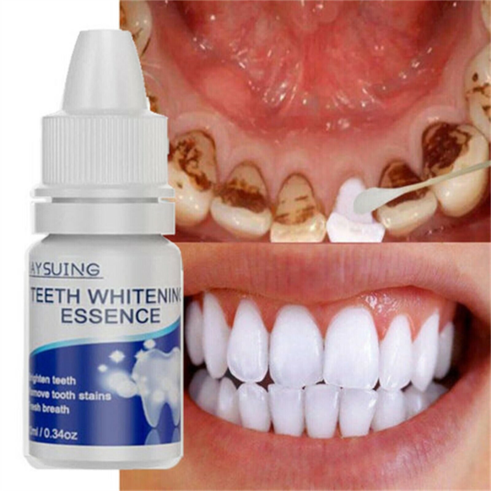 Teeth Whitening Essences Extra Strong White Hygiene Tooth Whitener Stain Removal Unbranded