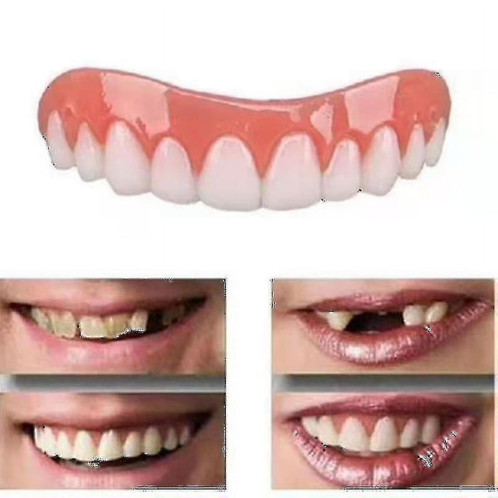 2 Sets Of Dentures, Upper And Lower Jaw Dentures, Natural And Comfortable, Protect The Teeth, A Confident Smile ZHONGYULI