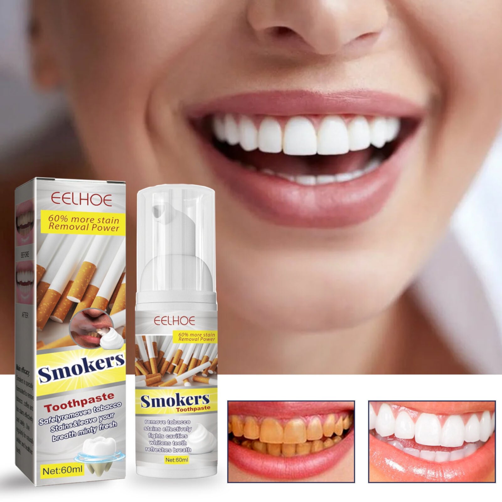 Hongssusuh Toothpaste Fresh Breath Smokers Toothpaste,Smokers Stain Removal Whitening Gel, Smokers Stains From Teeth, Fresh Breath Without Odor 60Ml Travel Toothpaste On Clearance Hongssusuh