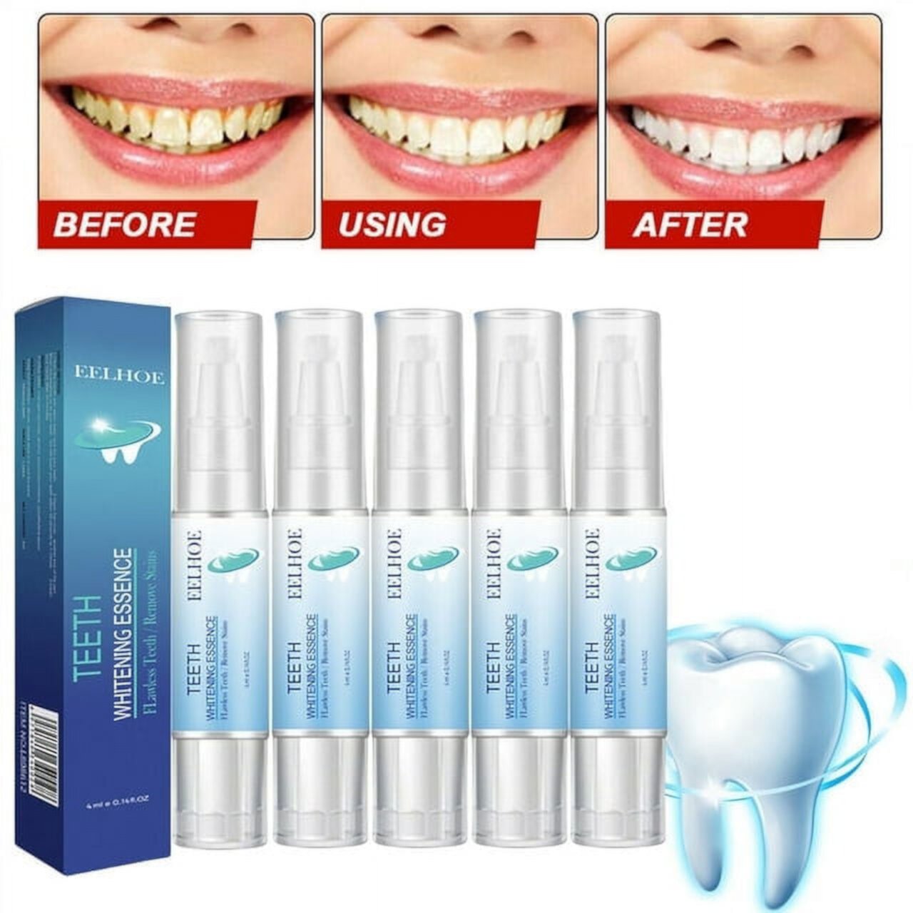 Teeth Whitening Essence, Teeth Whitening Essence Pen, Teeth Stain Remover to Whiten Teeth, Teeth Whitening Gel, Fast and Effective Removal Tooth Stain Removal MMQ