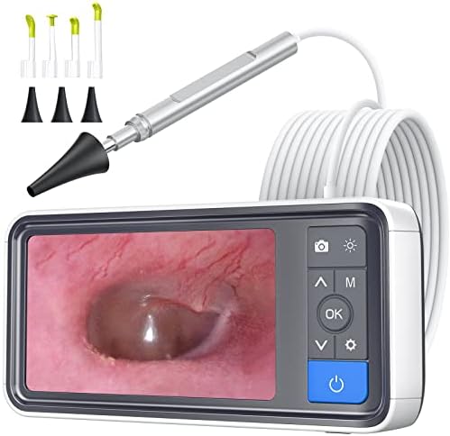 ScopeAround Otoscope Ear Camera with 4.5" IPS Screen, 1920x1080 FHD Smart Visual Ear Wax Removal Tool Camera Kit, 32GB Card Ear Scope Otoscope with Light, Plug & Play at Home Ear Infection Detector ScopeAround